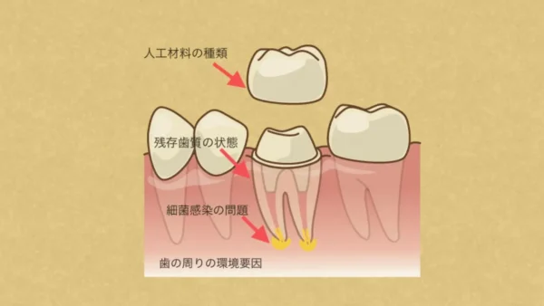 むし歯治療後の歯の寿命について