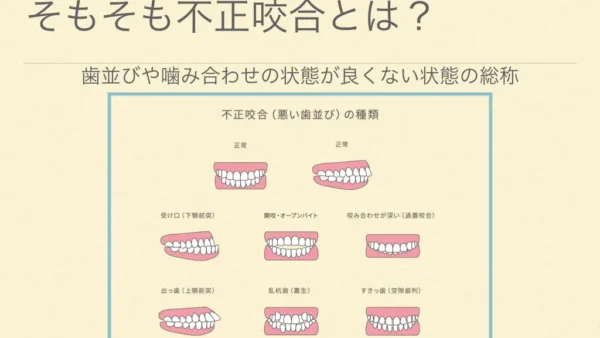 歯並び噛み合わせは「遺伝的要因」と「環境的要因」によって決まります！