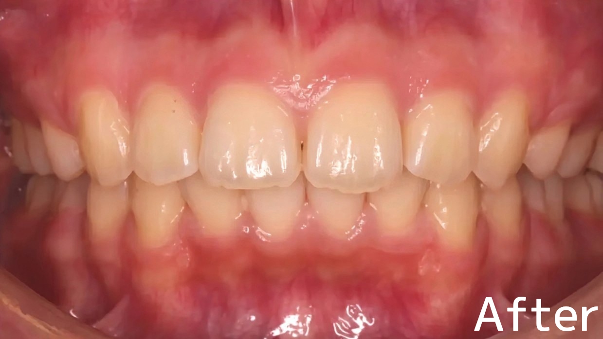 After image