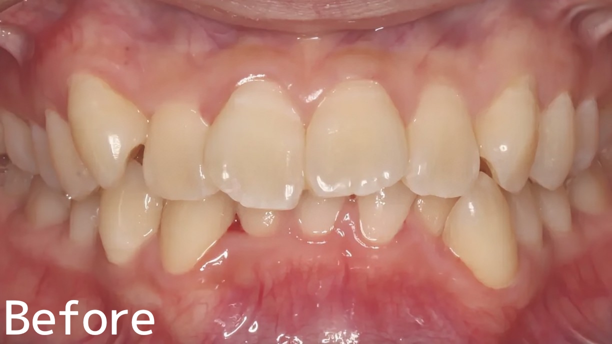Before image