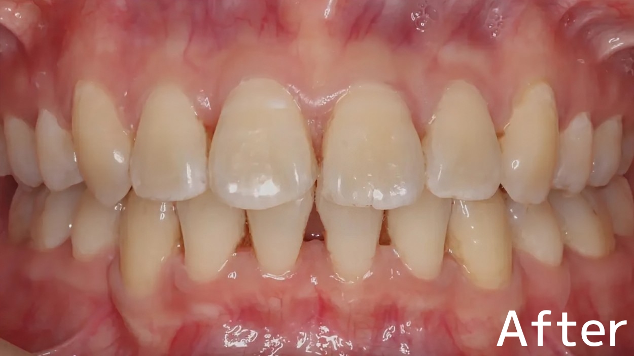 After image