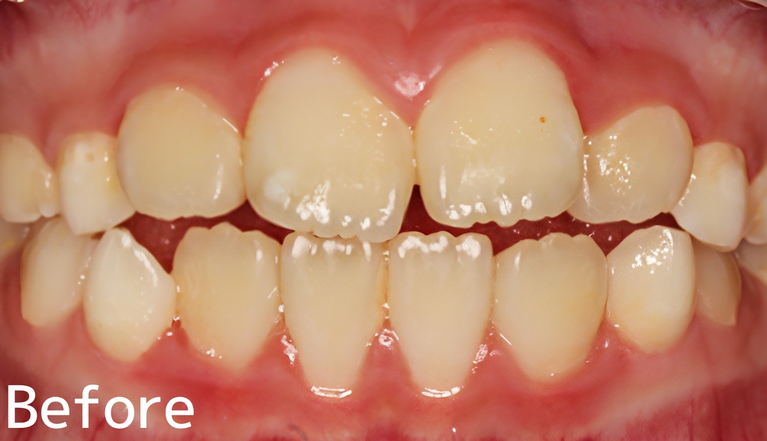 Before image