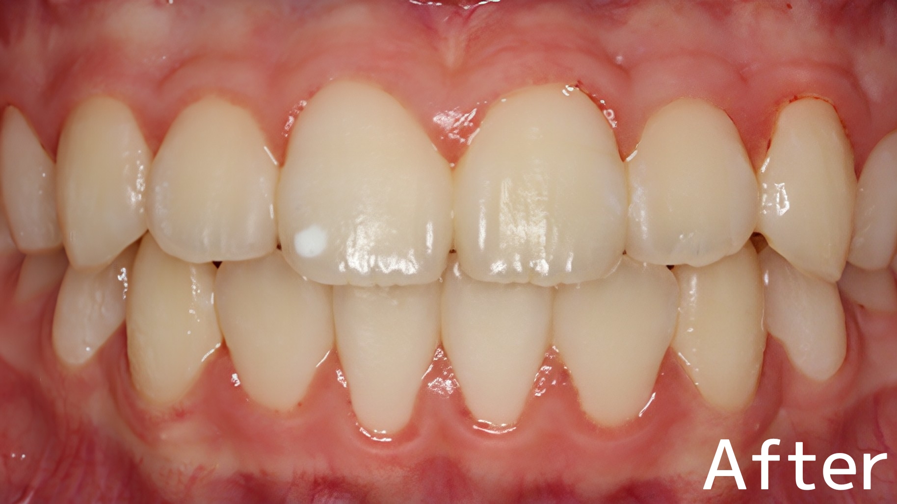 After image