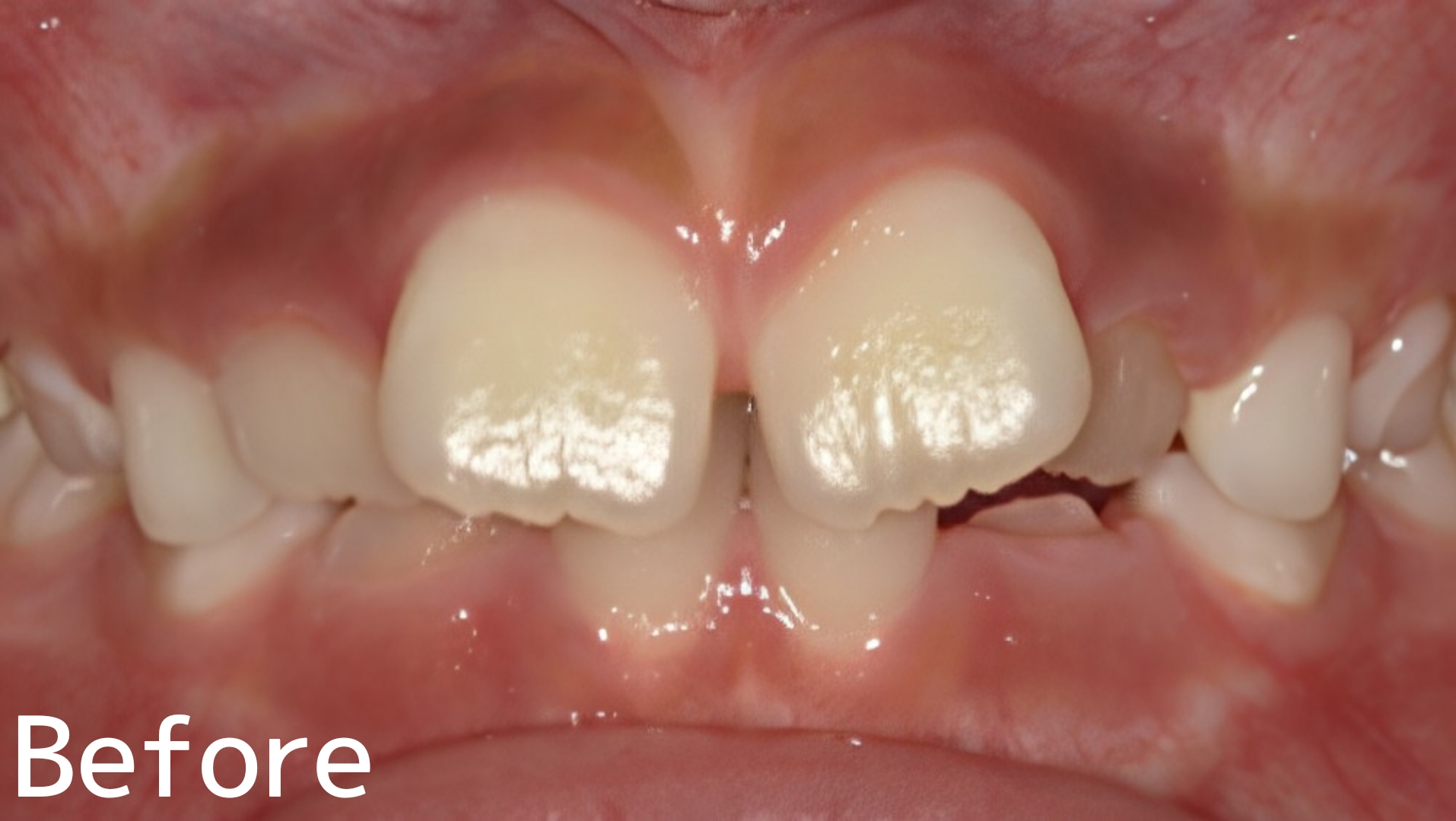 Before image
