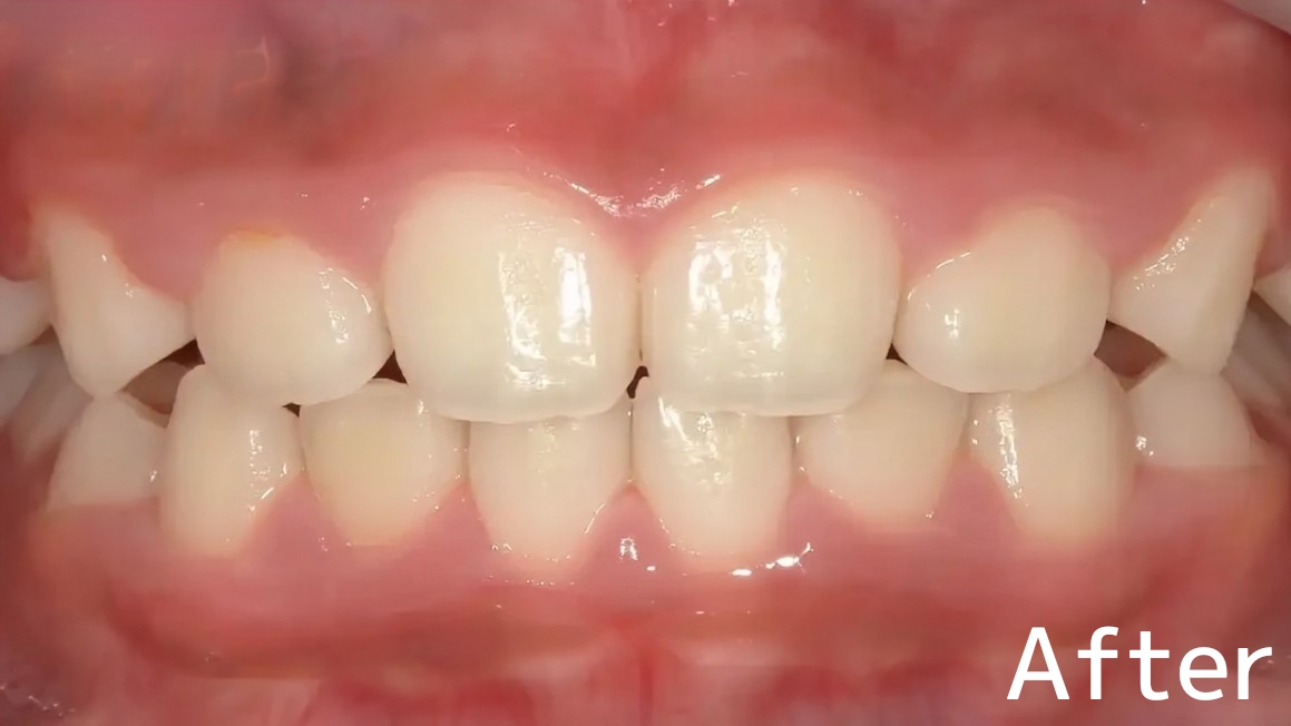 After image