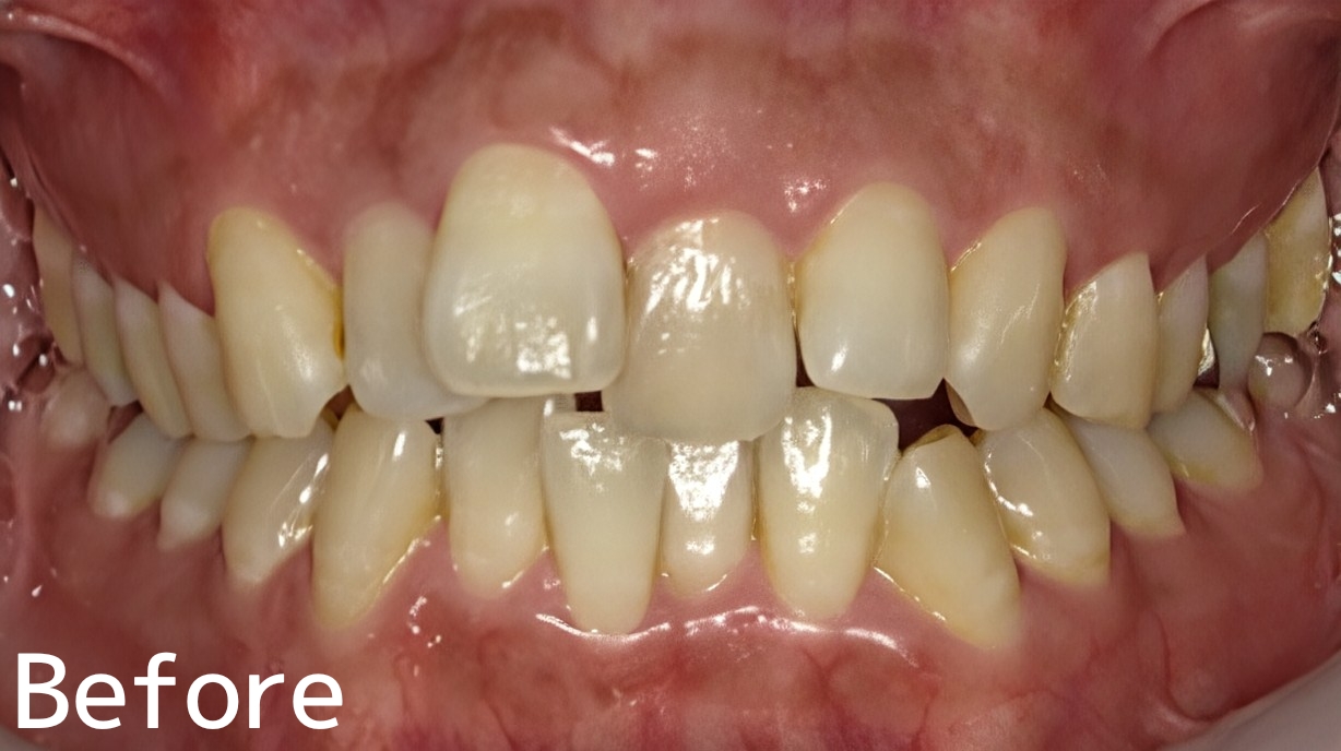 Before image
