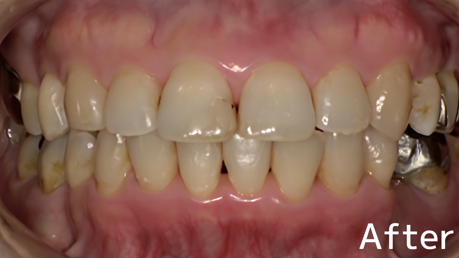 After image