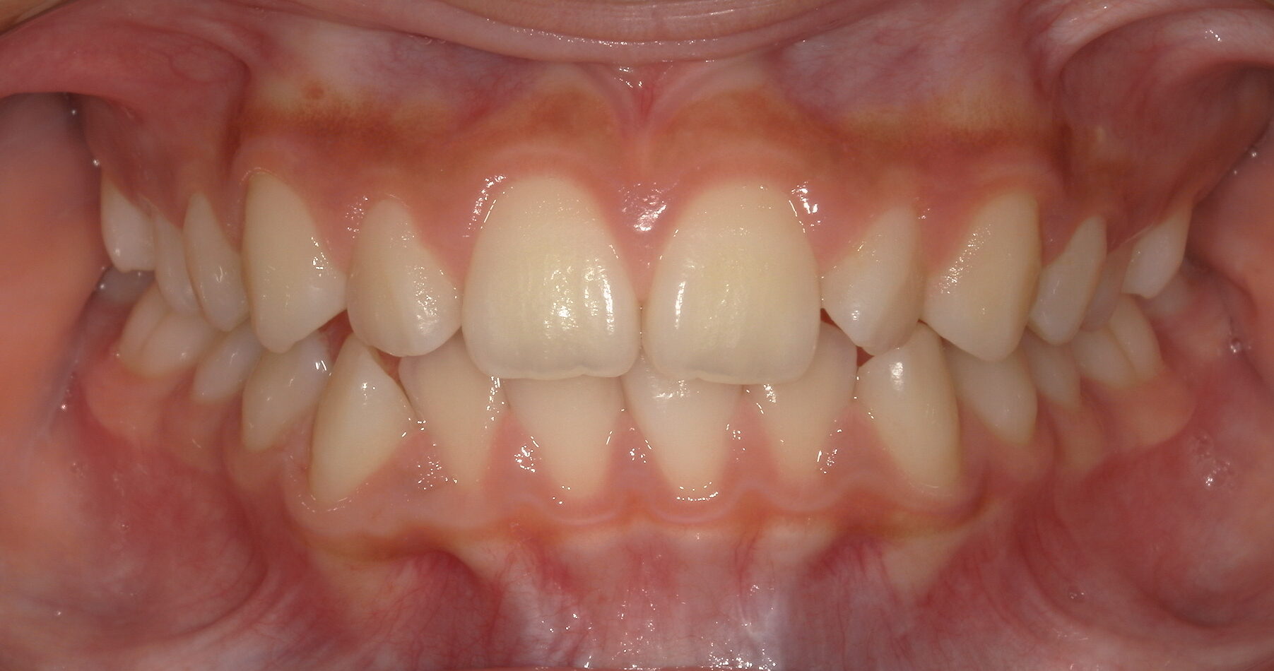 After image