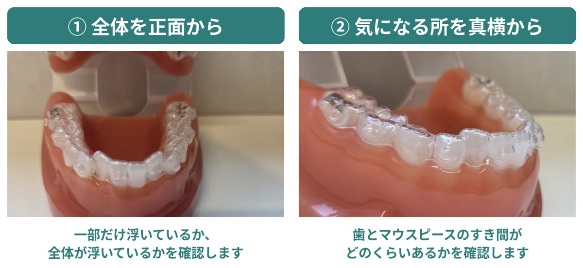 写真の撮り方の例。①全体を正面から、②気になる所を真横から