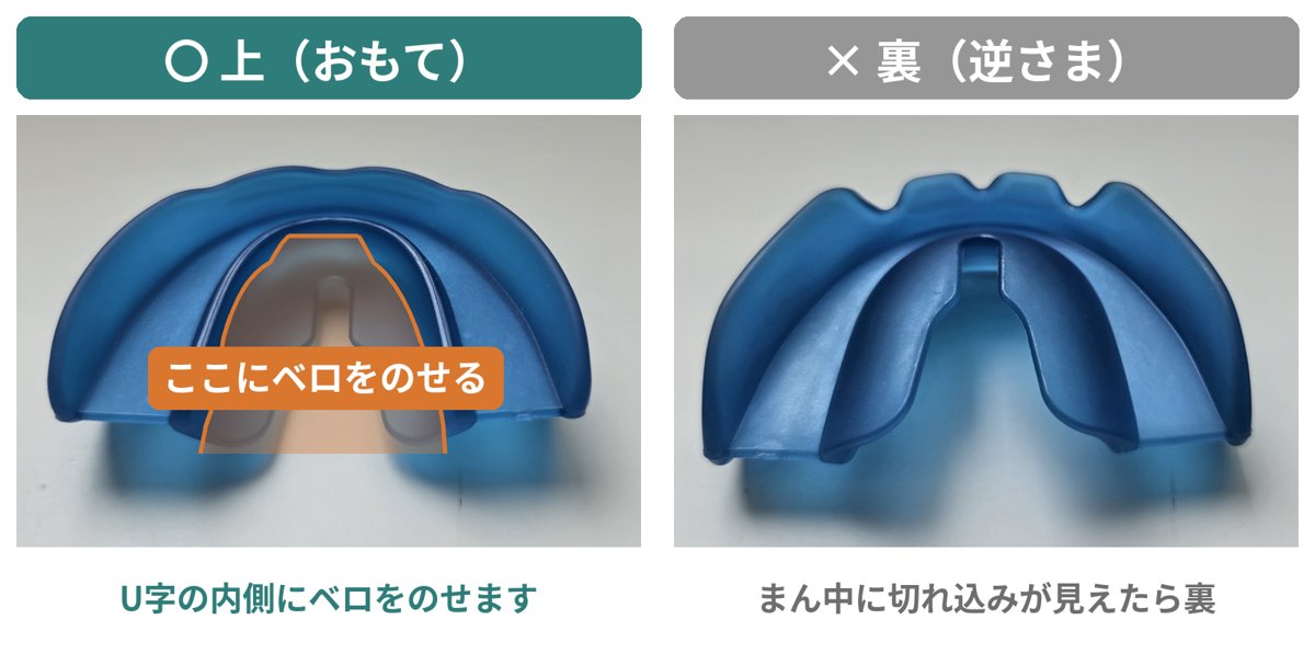 プレオルソの上と下の見分け方。U字の内側にベロをのせる面が上